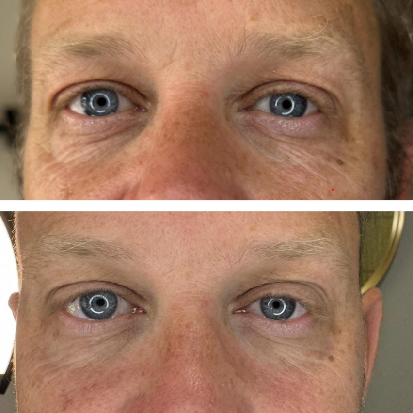 Skin Hautê Treatment