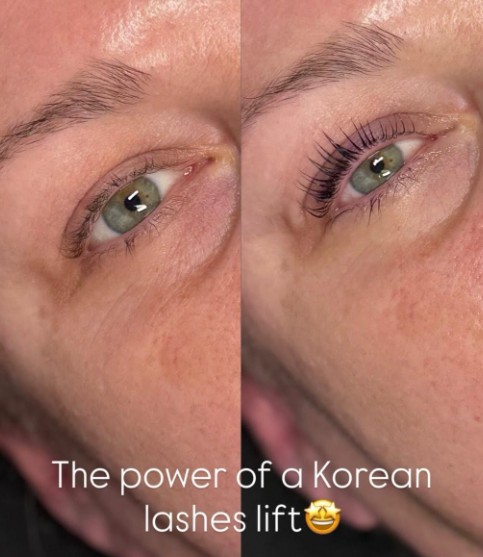 Skin Hautê Treatment